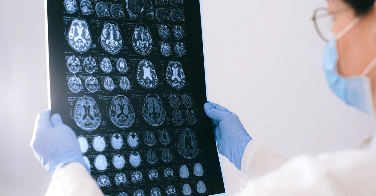 A medical professional examines printed MRI images of the brain.