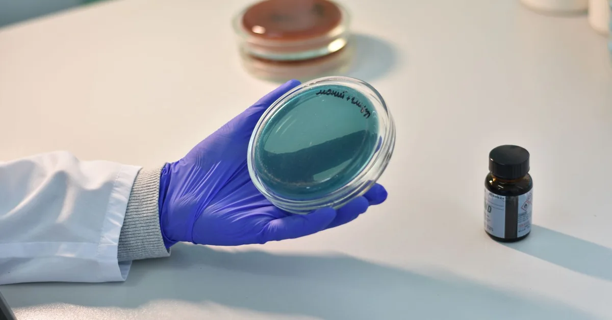 Scientist examines petri dish samples in a laboratory for research purposes.