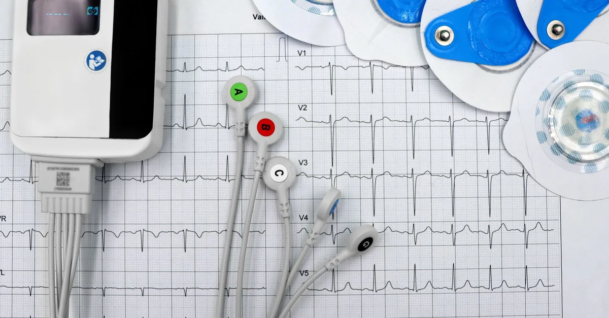 Close-up of ECG device with leads and electrodes on printed heart rate graph, showcasing medical technology.