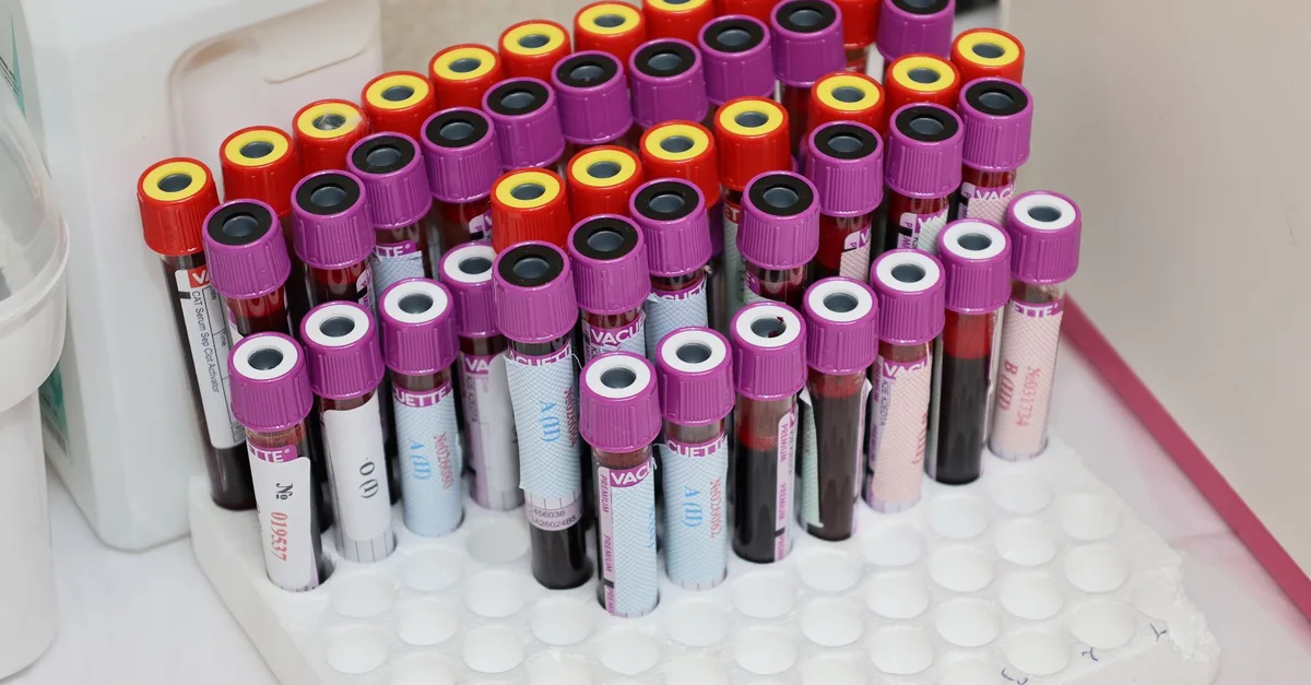 Rows of blood vials in a laboratory setting, ready for analysis.